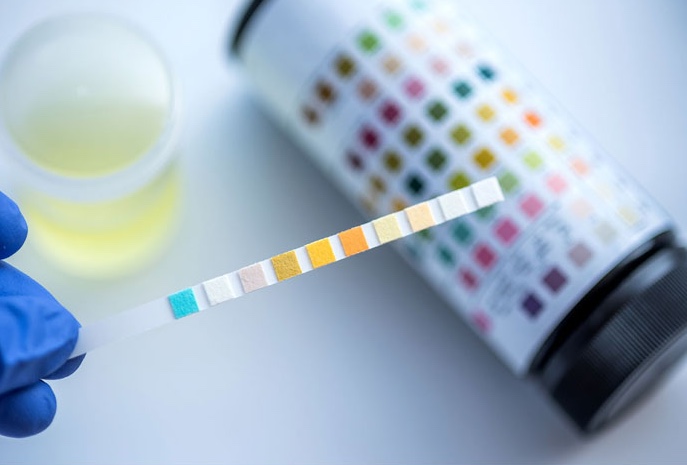 Urinalysis Test Strips